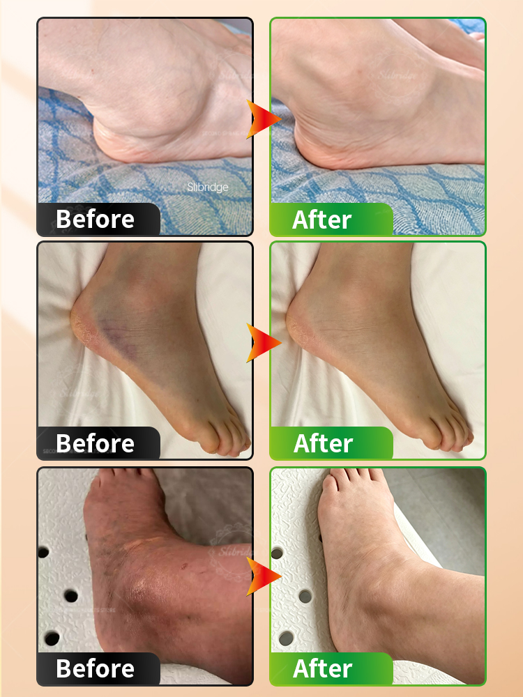 Pembalut Pemanas Pergelangan K - Ankle Brace Support ulasan dan harga